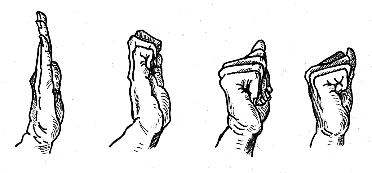 Carpal Tunnel 